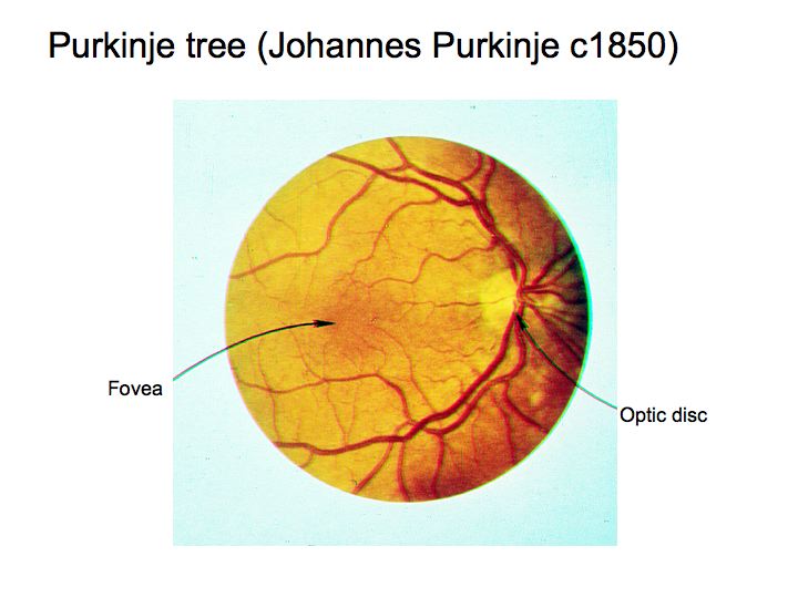 Shadows Cast by Retinal Blood Vessels Mapped in Primary Visual Cortex