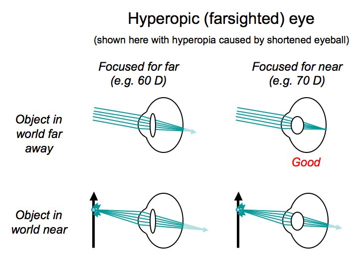 Perception Lecture Notes The Eye