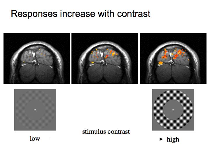 Normal Visual Response Perception Lecture Notes: Light/Dark Adaptation